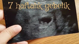 7 HAFTALIK GEBELIK | ANNE GÜNLÜĞÜ ( AILE ÇOCUK BEBEK GÜNLÜK HAYAT VLOG )