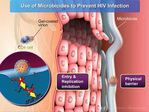 hiv the leading infectious disease in the world hiv the leading infectious disease in the world