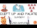 Cleft lip and palate surgery (Embryology, types, clinical features, treatment) #medvidsmadesimple