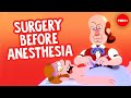 What did people do before anesthesia? - Sally Frampton