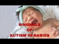 Early SIGNS of AUTISM in babies you NEED to KNOW
