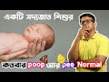 No of Poop & Pees normal for Newborn | সদ্যজাত কতবার পটি আর টয়লেট করা স্বাভাবিক | The Bong Parenting