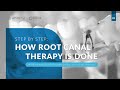 [Zen Dental] Storytelling: Step by Step: How Root Canal Therapy is Done