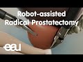 Robot-assisted Radical Prostatectomy (RARP)