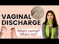 Vaginal Discharge- What's normal? What's not? | Dr Anjali Kumar | Maitri
