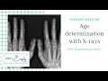 Age determination of X rays made Easy | Forensic Medicine | Med It Easy