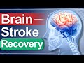 Brain Stroke Recovery | Paralysis Causes & Treatment | Dr. Puru Dhawan