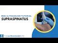How to view the Supraspinatus tendon on ultrasound