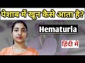 Hematuria|Blood in urine causes|hematuria symptoms in hindi |
