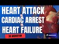 The Difference Between Cardiac Arrest, Heart Attack, and Heart Failure - 3D Animation