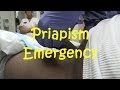 Priapism Emergency (Viewer Discretion Advised)