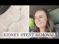 Kidney Stent Removal! | Let's Talk IBD