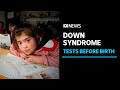 Why Down syndrome is almost non-existent in Iceland, and why people want that to change | ABC News