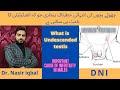 what is the treatment of undescended testis | what is undescended testes | DNI