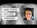 Diagnosed with stage 4 cancer - non-hodgkin's lymphoma