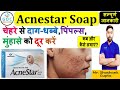 Acnestar Soap की  जानकारी | Acnestar Soap for Acne,Pimples | Benzoyl peroxide #acnetreatment #acne 🔥