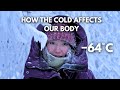 How Living in the World’s Coldest City Affects Our Body −64°C (−84°F)? Yakutsk, Siberia