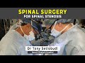 SURGERY FOR SPINAL STENOSIS