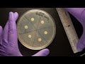 ID Laboratory Videos: Antibiotic susceptibility testing