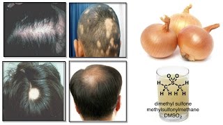 Full Hd Onion Benefits For Hair In Urdu Direct Download And Watch