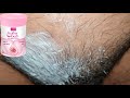 Vi John Hair Removal Cream Review | hair removal cream