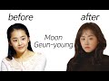 Moon Geun-young before and after