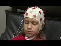 Brain treatment helps autism patients in Aventura