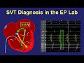 Diagnosis of SVT in the EP lab