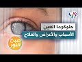 جلوكوما العين .. الأسباب والأعراض وطرق العلاج