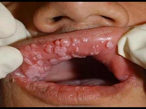 87 best Для мужчин. Поздравления, открытки. images on Интимная пластика - Beauty Doctor