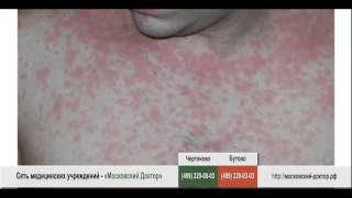 Как лечить аллергия на коже в домашних условиях Как лечить аллергия на коже в домашних условиях