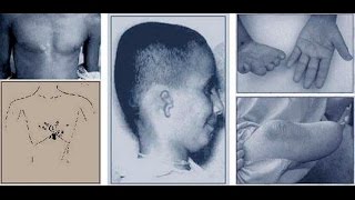 vizhu v sviblovo papillom udalenie dumayu chto pravi Удаление папиллом в свиблово фото