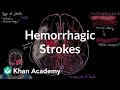 Hemorrhagic strokes | Circulatory System and Disease | NCLEX-RN | Khan Academy