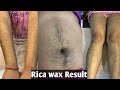 Result of rica wax after one month/Benifits of rica wax/#skincare #waxing #waxingtips #ricawax #wax