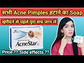 Acnestar soap Review | Acnestar Soap for Acne, Pimples | Detailed review, Uses, Benefits