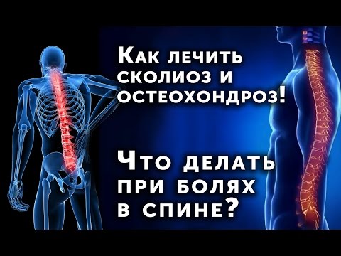 Что делать при боли при остеохондрозе Что делать при боли при остеохондрозе