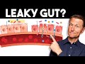 7 Signs of a Leaky Gut — Dr. Berg