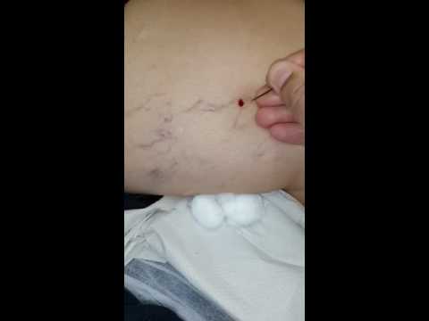 free-bloodletting-sex-videos-rights-reserved