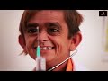CHOTU DADA M.B.B.S | छोटू डॉक्टर का खतरनाक इंजेक्शन | Khandesh Hindi Comedy | Chotu Comedy Video