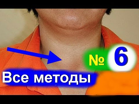 Вылечить щитовидку в домашних условиях Вылечить щитовидку в домашних условиях