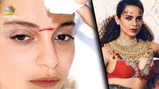 Kangana Ranaut admitted in hospital after injury during shoot | Hot Tamil Cinema News, Manikarnika