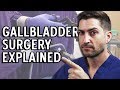 Gallbladder Surgery Explained - Complications and Recovery