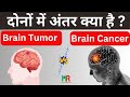 brain tumor and brain cancer in hindi | ब्रेन ट्यूमर और ब्रेन कैंसर की पूरी जानकारी हिंदी में |