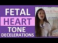 Fetal Heart Rate Tone Monitoring Decelerations | Early, Late, Variable NCLEX OB Maternity Nursing