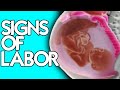Signs of Labor from a Midwife | How to Know When It's Time