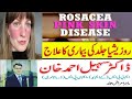 Rosacea | Face par Redness ka ilaj | Face ki redness khatam karne ka tareeqa | Sensitive Skin
