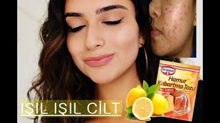 1 TL