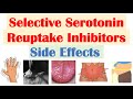 SSRI Antidepressant Side Effects (& Why They Occur) | Fluoxetine, Paroxetine, Sertraline, Citalopram