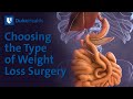 Choosing the Type of Weight Loss Surgery | Duke Health