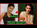 Shocking Plastic Surgery of South Indian Actresses | Samantha Akkineni, Kajal Aggarwal, Anushka
